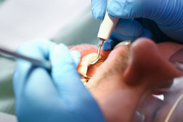 Best Emergency Dental Services for Seniors in Shenandoah, VA