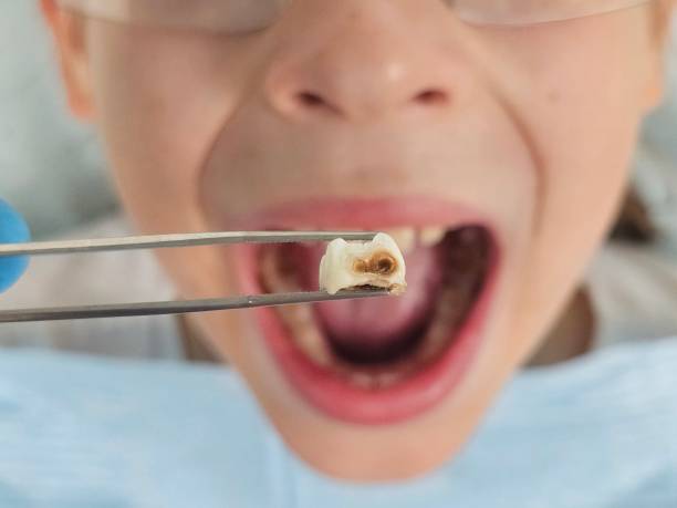 Best Emergency Cosmetic Dentistry in Shenandoah, VA